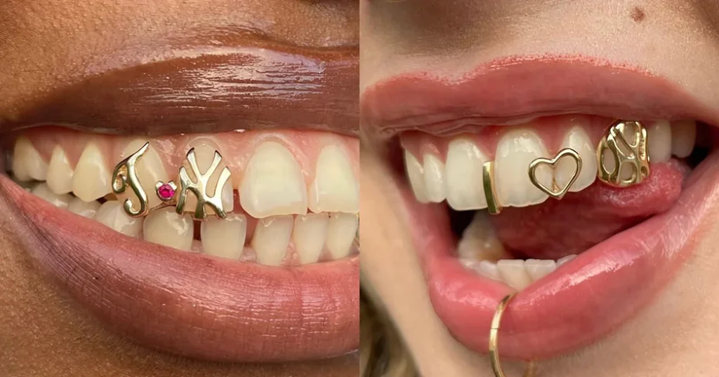 Fun Bridal Grills - Because even your smile deserves to shine on the big day
