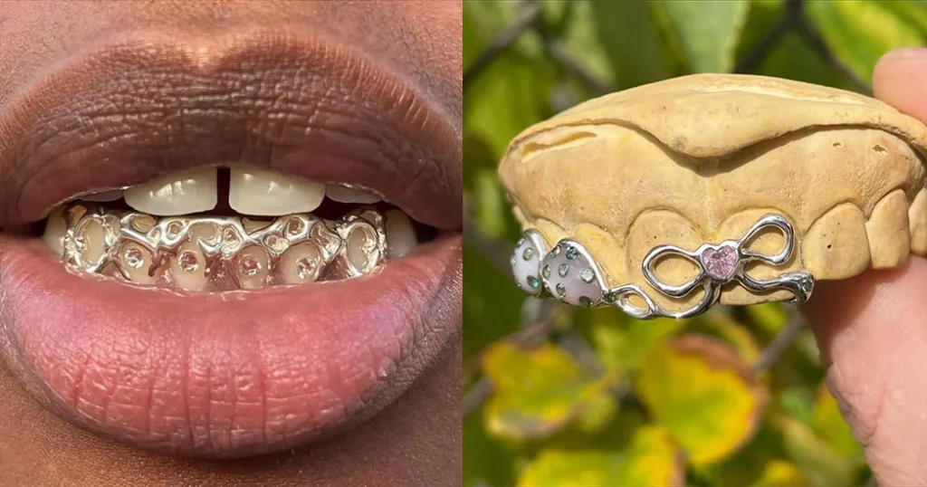 Fun Bridal Grills - Because even your smile deserves to shine on the big day