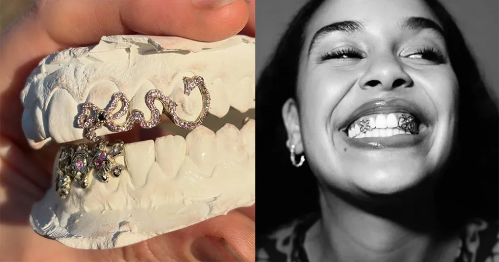 Fun Bridal Grills - Because even your smile deserves to shine on the big day