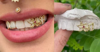 Fun Bridal Grills - Because even your smile deserves to shine on the big day