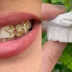 Fun Bridal Grills - Because even your smile deserves to shine on the big day