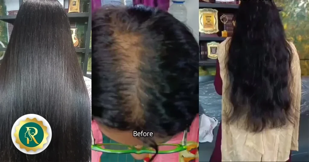 Ranjani’s Inspiring Journey in the World of Beauty & Hair Extensions!